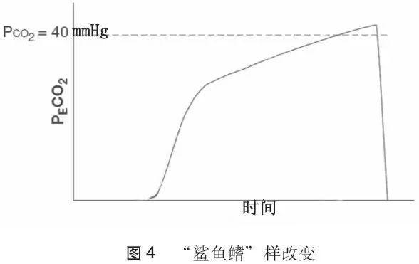 鲨鱼鳍.jpeg